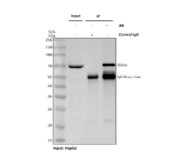 Immunoprecipitation of SDHA protein from 500ug of human HepG2 whole cell lysate with 2ug of SDHA antibody.