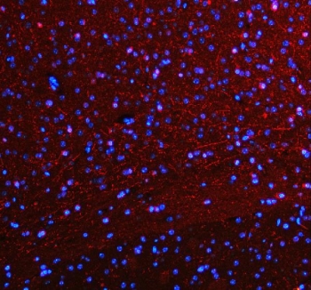 SERT Antibody Mouse Brain IF. Immunofluorescent staining of FFPE mouse brain tissue using SERT Antibody / Serotonin Reuptake Transporter Antibody demonstrates widespread red fluorescence associated with neural processes and neuropil-rich regions throughout the tissue. The staining pattern is consistent with expression of the Serotonin Transporter (SERT/SLC6A4), a membrane-associated protein responsible for serotonin reuptake and regulation of serotonergic neurotransmission. The extensive fibrillar and punctate signal observed within the brain parenchyma is consistent with localization of SERT to serotonergic neuronal projections and synaptic regions involved in neurotransmitter recycling and signal termination. Nuclei are counterstained with DAPI (blue). HIER: steam section in pH 8 EDTA buffer for 20 minutes prior to staining.