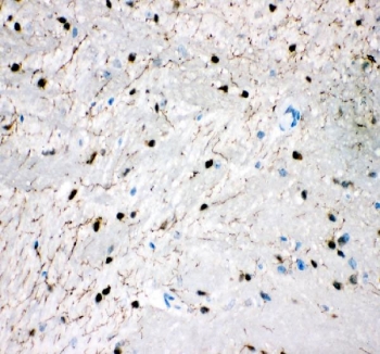 SERT Antibody Mouse Brain IHC. Immunohistochemistry staining of FFPE mouse brain tissue using SERT Antibody / Serotonin Reuptake Transporter Antibody demonstrates fine neuritic and neuropil-associated HRP-DAB brown staining distributed throughout the brain parenchyma. The staining pattern is consistent with expression of the Serotonin Transporter (SERT/SLC6A4), a membrane-associated protein that mediates serotonin reuptake and regulates serotonergic neurotransmission. The delicate fibrillar immunoreactivity highlights neuronal projections and serotonergic fiber networks rather than widespread neuronal cell body staining, consistent with the established localization of SERT within presynaptic axons and synaptic terminals. HIER: boil tissue sections in pH 8 EDTA buffer for 20 minutes and allow to cool before testing.