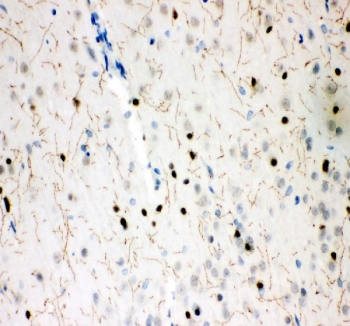 SERT Antibody Rat Brain IHC. Immunohistochemistry staining of FFPE rat brain tissue using SERT Antibody / Serotonin Reuptake Transporter Antibody demonstrates fine neuritic and neuropil-associated HRP-DAB brown staining throughout the brain parenchyma, accompanied by scattered neuronal cell body immunoreactivity. The staining pattern is consistent with expression of the Serotonin Transporter (SERT/SLC6A4), a membrane-associated transporter responsible for serotonin reuptake and maintenance of serotonergic neurotransmission. The extensive network of delicate fiber-like processes highlighted by the antibody is characteristic of serotonergic projections and synaptic regions where SERT regulates extracellular serotonin levels and neurotransmitter recycling. HIER: boil tissue sections in pH 8 EDTA buffer for 20 minutes and allow to cool before testing.