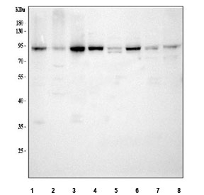 SERT Antibody Multi-Species WB. Western blot analysis of human SH-SY5Y, human U-2 OS, human SW620, human HeLa, rat brain, rat C6, mouse brain, and mouse Neuro-2a lysates using SERT Antibody / Serotonin Reuptake Transporter Antibody demonstrates a predominant immunoreactive band within the 85-95 kDa range across multiple samples. The observed molecular weight is consistent with glycosylated forms of the Serotonin Transporter (SERT/SLC6A4), a membrane-associated neurotransmitter transporter responsible for serotonin reuptake and regulation of serotonergic signaling. SERT is known to undergo extensive N-linked glycosylation, resulting in migration at higher apparent molecular weights than its unmodified core protein. Detection across human, rat, and mouse samples is consistent with the highly conserved nature of serotonergic neurotransmission and serotonin transporter biology. Minor lower molecular weight bands may represent less glycosylated species, degradation products, or alternatively processed forms of the transporter. Expected molecular weight: ~70 kDa (unglycosylated) and ~85-95 kDa (glycosylated).