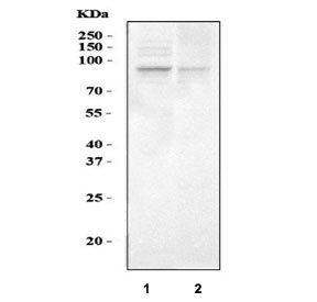 SERT Antibody Testis Tissue WB. Western blot analysis of rat testis and mouse testis tissue lysates using SERT Antibody / Serotonin Reuptake Transporter Antibody demonstrates a predominant immunoreactive band migrating within the 85-95 kDa range. The observed molecular weight is consistent with glycosylated forms of the Serotonin Transporter (SERT/SLC6A4), a membrane-associated transporter responsible for serotonin reuptake and regulation of serotonergic signaling. SERT is known to undergo extensive N-linked glycosylation, resulting in migration at a higher apparent molecular weight than the approximately 70 kDa unglycosylated core protein. Detection of SERT in testicular tissue is consistent with reports demonstrating serotonergic signaling components in reproductive tissues, where serotonin may contribute to regulation of spermatogenesis, cellular communication, and reproductive physiology. Expected molecular weight: ~70 kDa (unglycosylated) and ~85-95 kDa (glycosylated).