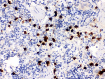 IHC testing of FFPE rat spleen with S100A9 antibody. HIER: Boil the paraffin sections in pH 6, 10mM citrate buffer for 20 minutes and allow to cool prior to staining.