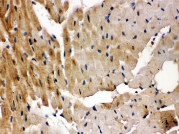 IHC testing of FFPE rat heart with GRK5 antibody. HIER: Boil the paraffin sections in pH 6, 10mM citrate buffer for 20 minutes and allow to cool prior to staining.
