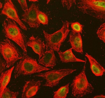Immunofluorescent staining of FFPE human U-2 OS cells with STAT3 antibody (green) and Beta Tubulin mAb (red). HIER: steam section in pH6 citrate buffer for 20 min.
