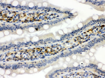 STAT1 Antibody Rat Intestine IHC. Immunohistochemistry staining of FFPE rat intestine tissue using STAT1 antibody demonstrates distinct staining within intestinal epithelial and mucosal-associated cell populations, consistent with expression of Signal Transducer and Activator of Transcription 1 (STAT1). STAT1 is a key transcription factor within the JAK-STAT signaling pathway that mediates cellular responses to interferons, cytokines, and immune regulatory signals. The observed staining pattern is consistent with the role of STAT1 in regulating transcriptional programs involved in epithelial homeostasis, immune surveillance, and cytokine-responsive signaling within gastrointestinal tissues. These findings support the utility of STAT1 antibody for studies of signal transduction, immune regulation, and tissue-specific gene expression. HIER: boil paraffin sections in pH 6 10mM citrate buffer for 20 minutes and allow to cool prior to staining.