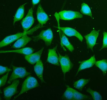 Immunofluorescence analysis of JNK2/MAPK9 expression in HeLa cells. Human HeLa cells were fixed and stained with anti-JNK2/MAPK9 antibody, followed by Fluoro488-conjugated goat anti-rabbit IgG secondary antibody (green). Nuclei were counterstained with DAPI (blue). JNK2/MAPK9 signal is observed predominantly in the cytoplasm with variable perinuclear distribution, consistent with stress-activated MAPK localization patterns.