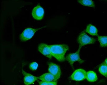 MKK3 Antibody / p38 MAP Kinase Kinase Antibody CACO-2 Immunofluorescence. Immunofluorescent staining of FFPE human CACO-2 cells using MKK3 Antibody / p38 MAP Kinase Kinase Antibody (green) with DAPI nuclear counterstain (blue). Heat-induced epitope retrieval was performed by steaming sections in pH 6.0 citrate buffer for 20 minutes before staining. MKK3 exhibits predominantly cytoplasmic staining, consistent with its function as a dual-specificity kinase that activates p38 MAP kinases in response to inflammatory cytokines, cellular stress, and environmental stimuli. This staining pattern supports the use of the antibody for investigating p38 MAPK signaling, stress-responsive pathways, inflammation, and cancer biology.