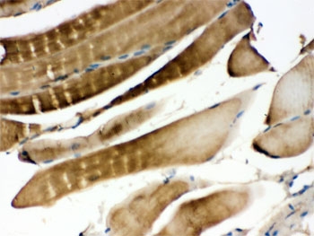 MKK3 Antibody / p38 MAP Kinase Kinase Antibody Mouse Skeletal Muscle IHC. Immunohistochemical staining of FFPE mouse skeletal muscle tissue using MKK3 Antibody / p38 MAP Kinase Kinase Antibody. MKK3 expression is detected throughout skeletal muscle fibers, consistent with its role as a stress-responsive dual-specificity kinase that activates the p38 MAPK signaling pathway involved in muscle differentiation, regeneration, and adaptation to cellular stress. Heat-induced epitope retrieval was performed by boiling tissue sections in pH 6.0 citrate buffer for 20 minutes followed by cooling before staining. This staining pattern demonstrates the utility of the antibody for investigating p38 MAPK signaling in skeletal muscle physiology, development, and disease.