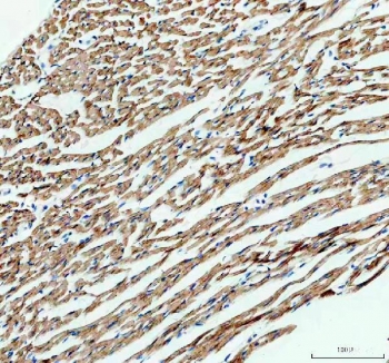 IHC staining of FFPE rat heart tissue with IDH2 antibody. HIER: boil tissue sections in pH8 EDTA for 20 min and allow to cool before testing.