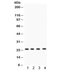 Western blot testing of 1) rat brain, 2) mouse spleen, 3) human HeLa and 4) human MCF7 lysate with RAB7 antibody. Expected molecular weight ~23 kDa.