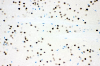 IHC staining of FFPE mouse brain tissue with ATXN1 antibody. HIER: boil tissue sections in pH8 EDTA for 20 min and allow to cool before testing.