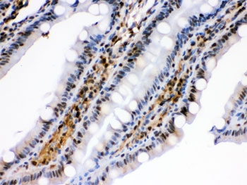 IHC testing of FFPE rat intestine with HSPA2 antibody. HIER: Boil the paraffin sections in pH 6, 10mM citrate buffer for 20 minutes and allow to cool prior to staining.