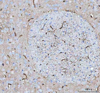 IHC testing of FFPE rat brain with AQP4 antibody. HIER: Boil the paraffin sections in pH 8 EDTA buffer for 20 minutes and allow to cool prior to staining.
