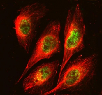 Immunofluorescent staining of FFPE human U-2 OS cells with FOXA3 antibody (green) and Beta Tubulin mAb (red). HIER: steam section in pH6 citrate buffer for 20 min.