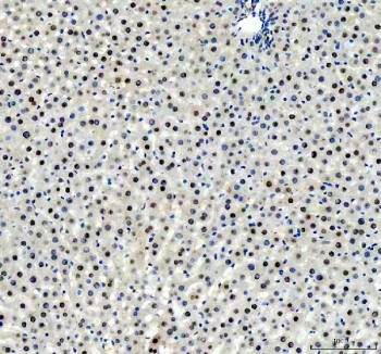 IHC staining of FFPE rat liver tissue with FOXA3 antibody. HIER: boil tissue sections in pH8 EDTA for 20 min and allow to cool before testing.