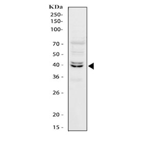 Western blot testing of human HepG2 cell lysate with FOXA3 antibody. Expected molecular weight ~37 kDa.