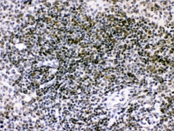 IHC testing of FFPE mouse spleen with RAG2 antibody. HIER: Boil the paraffin sections in pH 6, 10mM citrate buffer for 20 minutes and allow to cool prior to staining.