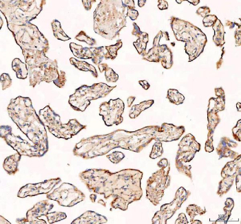 IHC staining of FFPE human placental tissue with RAB14 antibody, HRP-labeled secondary and DAB substrate. HIER: boil tissue sections in pH8 EDTA for 20 min and allow to cool before testing.