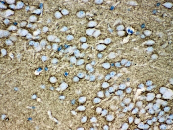 MUNC18-1 Antibody Mouse Brain IHC. Immunohistochemical staining of FFPE mouse brain tissue with MUNC18-1 antibody. Heat-induced epitope retrieval (HIER) was performed by boiling tissue sections in pH 6, 10 mM citrate buffer for 20 minutes and allowing them to cool prior to staining. Strong MUNC18-1 immunoreactivity is observed throughout the brain parenchyma, with prominent cytoplasmic staining of neuronal cell bodies and processes, consistent with the expected neuronal expression pattern of STXBP1. Cell nuclei are counterstained with hematoxylin (blue).