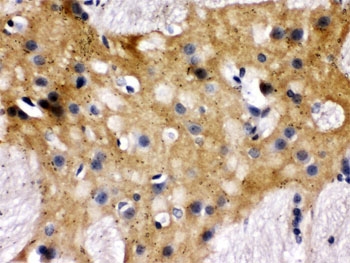MUNC18-1 Antibody Rat Brain IHC. Immunohistochemical staining of FFPE rat brain tissue with MUNC18-1 antibody. Heat-induced epitope retrieval (HIER) was performed by boiling tissue sections in pH 6, 10 mM citrate buffer for 20 minutes and allowing them to cool prior to staining. Strong MUNC18-1 immunoreactivity is observed predominantly within the cytoplasm of neurons throughout the brain, with diffuse staining extending into the surrounding neuropil, consistent with the expected neuronal localization of STXBP1. Cell nuclei are counterstained with hematoxylin (blue).