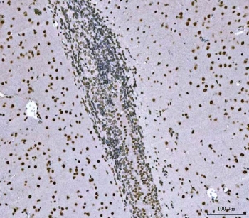IHC staining of FFPE rat brain tissue with SNRPN antibody. HIER: boil tissue sections in pH8 EDTA for 20 min and allow to cool before testing.