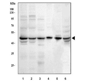 Western blot testing of 1) human HeLa, 2) human MCF7, 3) human Jurkat, 4) human T-47D, 5) rat spleen and 6) mouse RAW264.7 cell lysate with YB1 antibody. Expected molecular weight: 39~50 kDa depending on glycosylation level.