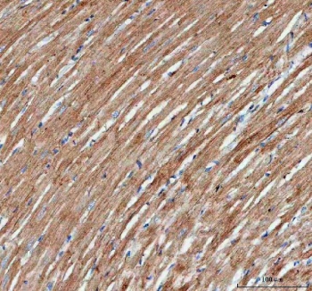 IHC staining of FFPE rat heart tissue with Actin antibody. HIER: Boil the paraffin sections in pH8 EDTA buffer for 20 minutes and allow to cool prior to staining.