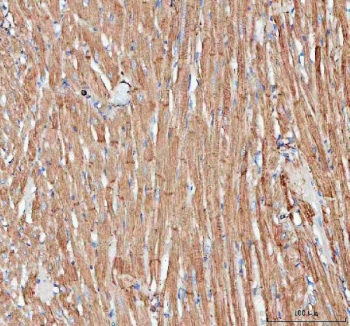 IHC staining of FFPE rat heart tissue with anti-Actin antibody. HIER: boil tissue sections in pH8 EDTA for 20 min and allow to cool before testing.