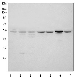 Western blot analysis of Cyclin A1 (CCNA1) expression using Cyclin A1 antibody. Lane 1: human 293T whole cell lysates; Lane 2: human MCF-7 whole cell lysates; Lane 3: human HeLa whole cell lysates; Lane 4: rat kidney tissue lysates; Lane 5: rat testis tissue lysates; Lane 6: mouse kidney tissue lysates; Lane 7: mouse testis tissue lysates. The predicted molecular weight of Cyclin A1 is ~52 kDa, and a corresponding band is observed across cell lines and tissues, with stronger expression in testis samples.
