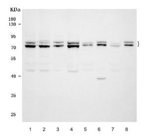 Western blot testing of 1) human HeLa, 2) human 293T, 3) human Jurkat, 4) human K562, 5) rat brain, 6) rat liver, 7) mouse brain and 8) mouse liver lysate with FMRP antibody. Predicted molecular weight ~71 kDa with multiple isoforms observed at 67-90 kDa.