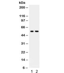 Western blot testing of human 1) HeLa and 2) Jurkat lysate with TRAF2 antibody. Predicted/expected molecular weight ~56 kDa.