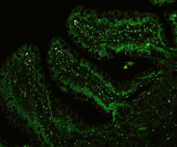 Immunofluorescent staining of FFPE rat intestinal tissue with CTBP1 antibody. HIER: steam section in pH6 citrate buffer for 20 min.