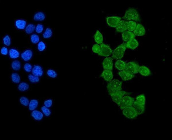 IKZF1 Antibody MCF-7 IF. Immunofluorescent staining of MCF-7 cells using IKZF1 Antibody / Ikaros Family Zinc Finger 1 Antibody demonstrates strong green fluorescence within the cellular compartment, consistent with expression of IKZF1 (Ikaros), a zinc finger transcription factor that regulates hematopoietic differentiation, lymphoid development, and gene expression programs involved in cellular fate determination. Positive immunoreactivity confirms detection of endogenous IKZF1 and supports the utility of this antibody for immunofluorescence applications. Nuclei are counterstained with DAPI (blue). Enzymatic antigen retrieval was performed for 15 min prior to staining, followed by incubation with IKZF1 antibody (5 ug/ml) overnight at 4Â°C and DyLight 488-conjugated secondary antibody detection.