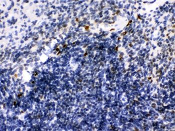 IKZF1 Antibody Mouse Spleen IHC. Immunohistochemical staining of FFPE mouse spleen tissue using IKZF1 Antibody / Lymphoid Development Transcription Factor Antibody demonstrates distinct nuclear HRP-DAB brown staining within scattered lymphoid cell populations. The staining pattern is consistent with expression of IKZF1 (Ikaros), a master regulator of lymphoid development that controls transcriptional programs required for lymphocyte differentiation, immune cell maturation, and hematopoietic lineage commitment. Predominantly nuclear immunoreactivity is expected for this DNA-binding transcription factor and reflects its central role in regulating gene expression during immune system development and maintenance. These findings support the utility of this antibody for immunohistochemical detection of endogenous IKZF1 in lymphoid tissues. HIER: boil paraffin sections in pH 6, 10mM citrate buffer for 20 min and allow to cool prior to staining.
