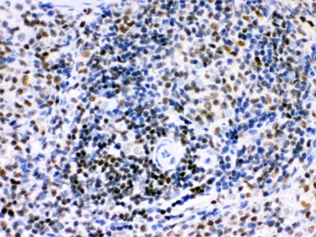 IKZF1 Antibody Rat Spleen IHC. Immunohistochemical staining of FFPE rat spleen tissue using IKZF1 Antibody / Lymphoid Development Transcription Factor Antibody demonstrates distinct nuclear HRP-DAB brown staining within lymphoid cell populations. The staining pattern is consistent with expression of IKZF1 (Ikaros), a master regulator of lymphoid lineage commitment that directs transcriptional programs required for lymphocyte differentiation, immune cell maturation, and hematopoietic development. Positive nuclear immunoreactivity is expected for this DNA-binding transcription factor and highlights its essential role in regulating gene expression networks that govern normal lymphoid cell function and immune system formation. The observed staining supports the utility of this antibody for immunohistochemical detection of endogenous IKZF1 in lymphoid tissues. HIER: boil paraffin sections in pH 6, 10mM citrate buffer for 20 min and allow to cool prior to staining.