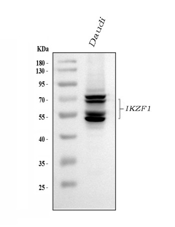 IKZF1 Antibody Daudi WB. Western blot analysis of human Daudi cell lysate using IKZF1 Antibody / Ikaros Family Zinc Finger 1 Antibody demonstrates multiple immunoreactive bands between approximately 50â70 kDa, consistent with the known molecular weight range of IKZF1 (Ikaros). IKZF1 undergoes extensive alternative splicing, generating multiple protein isoforms that differ in DNA-binding and regulatory domains, resulting in the characteristic multi-band pattern frequently observed in lymphoid cells. As a master regulator of hematopoietic and lymphoid differentiation, IKZF1 plays essential roles in immune cell development, transcriptional regulation, and chromatin remodeling. Detection of multiple endogenous IKZF1 isoforms in Daudi cells supports the specificity of this antibody for western blot applications. Predicted molecular weight: ~50â70 kDa. Observed molecular weights: ~50â70 kDa.