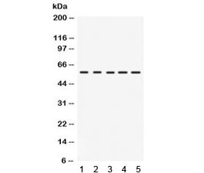 IRF5 Antibody Human, Mouse and Rat WB. Western blot analysis was performed using IRF5 Antibody. Lane 1: rat intestine lysate; lane 2: human HeLa cell lysate; lane 3: human COLO320 cell lysate; lane 4: mouse NIH3T3 cell lysate; lane 5: mouse HEPA1-6 cell lysate. A specific immunoreactive band is detected at approximately 57 kDa in all tested samples, consistent with the expected molecular weight of IRF5. These results demonstrate that this Immune Response Regulator Antibody is suitable for Western blot detection of IRF5 across human, mouse, and rat samples.