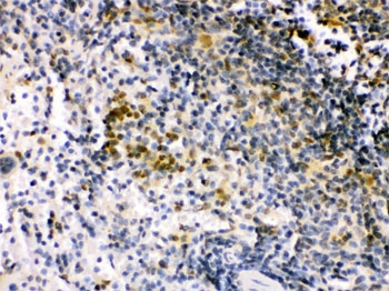 IRF5 Antibody Mouse Spleen IHC. Immunohistochemistry was performed on FFPE mouse spleen tissue using IRF5 Antibody. Heat-induced epitope retrieval was performed by boiling tissue sections in pH 6, 10 mM citrate buffer for 20 minutes followed by cooling prior to incubation with the primary antibody. Bound antibody was visualized using an HRP-conjugated secondary antibody and DAB chromogen. Distinct nuclear staining is observed within splenic immune cell populations, consistent with the role of IRF5 as an immune response-regulating transcription factor. These results demonstrate that this Immune Response Regulator Antibody is suitable for immunohistochemical detection of IRF5 in formalin-fixed, paraffin-embedded mouse spleen tissue.