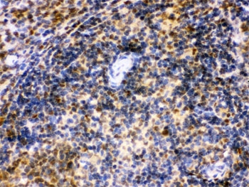 IRF5 Antibody Rat Spleen IHC. Immunohistochemistry was performed on FFPE rat spleen tissue using IRF5 Antibody. Heat-induced epitope retrieval was performed by boiling tissue sections in pH 6, 10 mM citrate buffer for 20 minutes followed by cooling prior to incubation with the primary antibody. Bound antibody was visualized using an HRP-conjugated secondary antibody and DAB chromogen. Predominantly nuclear staining is observed throughout splenic immune cell populations, consistent with the role of IRF5 as an immune response-regulating transcription factor. These results demonstrate that this Immune Response Regulator Antibody is suitable for immunohistochemical detection of IRF5 in formalin-fixed, paraffin-embedded rat spleen tissue.