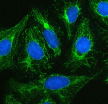 Plectin Antibody U-2 OS Cytoskeleton IF. Immunofluorescent staining of human U-2 OS cells demonstrates plectin expression using a Plectin antibody (green). Plectin is a cytolinker protein that interconnects intermediate filaments, microtubules, and actin filaments to maintain cellular architecture and mechanical stability. A dense filamentous network extending throughout the cytoplasm and into cellular processes is observed, highlighting the role of plectin in organizing the cytoskeleton and supporting cell shape. DAPI was used as a nuclear counterstain (blue). Heat induced epitope retrieval was performed by boiling sections in pH 6 10 mM citrate buffer for 20 minutes followed by cooling prior to staining. These results support the utility of Plectin Antibody for studies of cytoskeletal dynamics, cell adhesion, mechanotransduction, and tumor cell biology.