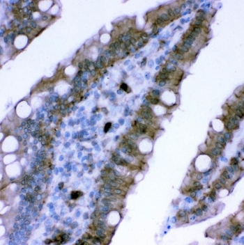 Plectin Antibody Rat Intestinal Epithelium IHC. Immunohistochemical staining of FFPE rat intestine demonstrates plectin expression using a Plectin antibody. Plectin is a versatile cytolinker protein that anchors intermediate filaments to membrane associated complexes and helps preserve epithelial architecture under conditions of mechanical stress. Distinct cytoplasmic and circumferential membranous staining is observed in absorptive epithelial cells lining the intestinal villi, consistent with the localization of plectin within junctional and cytoskeletal networks. Heat induced epitope retrieval was performed by boiling paraffin sections in pH 8 EDTA buffer for 20 minutes followed by cooling prior to staining. These results support the utility of Plectin Antibody for investigations of epithelial integrity, cytoskeletal organization, and tissue homeostasis.