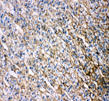 SRB1 Antibody Rat Adrenal Cortex IHC. Immunohistochemical staining of FFPE rat adrenal gland showed strong membrane and cytoplasmic SRB1 expression throughout the adrenal cortex, with minimal staining in surrounding stromal regions. Heat-induced epitope retrieval was performed in pH8 EDTA buffer prior to staining with HRP-DAB detection. The staining pattern is consistent with the high expression of SCARB1 in steroidogenic cells that utilize HDL-derived cholesterol for steroid hormone synthesis. This SRB1 Antibody, an SCARB1 Antibody, is well suited for immunohistochemical studies of adrenal steroidogenesis, cholesterol transport and endocrine tissue biology.