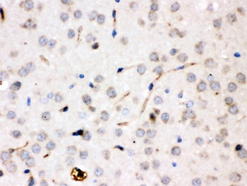 CP Antibody Rat Brain IHC. Immunohistochemical staining of FFPE rat brain tissue using CP antibody demonstrates selective staining of scattered neural parenchymal cells with delicate cellular processes extending through the surrounding tissue. The staining pattern is consistent with expression of Ceruloplasmin (CP), a multicopper ferroxidase that contributes to iron metabolism, copper transport, and maintenance of metal ion homeostasis within the central nervous system. In addition to its role as a major circulating plasma protein, Ceruloplasmin participates in local regulation of iron handling and redox balance in neural tissues, helping support normal cellular function and protection from metal-associated oxidative stress. The observed staining distribution is consistent with the established involvement of Ceruloplasmin in neural iron homeostasis. HIER: boil paraffin sections in pH 6, 10 mM citrate buffer for 20 minutes and allow to cool prior to staining.