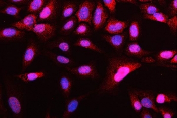 Immunofluorescent staining of FFPE human U-2 OS cells with ATG14L antibody (red) and DAPI nuclear stain (blue). HIER: steam section in pH6 citrate buffer for 20 min.
