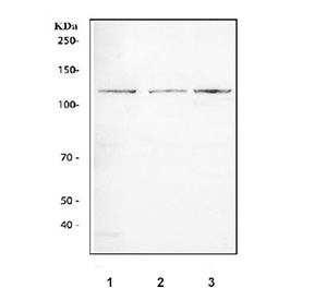Western blot testing of 1) rat testis, 2) mouse testis and 3) mouse thymus tissue lysate with TRIF antibody. A single TRIF band was detected between ~100-110 kDa, migrating above the predicted 76 kDa, consistent with the well-documented phosphorylation-dependent and proline-rich region-related upward mobility of endogenous TRIF reported in the literature.