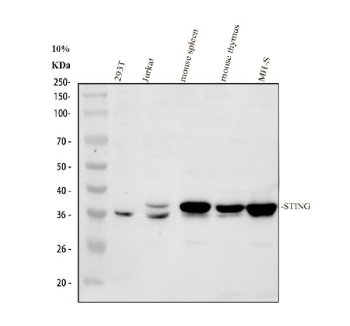 Western blot analysis of STING/TMEM173 Antibody. Proteins were resolved by 10% SDS-PAGE and transferred to a nitrocellulose membrane prior to immunodetection. Lane 1: human 293T whole cell lysates; Lane 2: human Jurkat whole cell lysates; Lane 3: mouse spleen tissue lysates; Lane 4: mouse thymus tissue lysates; Lane 5: mouse MH-S whole cell lysates. A prominent band corresponding to TMEM173 was detected at approximately 35 kDa across multiple samples. Although the predicted molecular weight of STING is approximately 42 kDa based on amino acid sequence, STING is well documented to migrate at a lower apparent molecular weight on SDS-PAGE, likely due to its multi-pass transmembrane architecture, hydrophobic regions, and detergent-dependent electrophoretic behavior. Lower apparent migration and subtle band heterogeneity have been reported for STING in both human and mouse tissues, and the observed banding pattern is consistent with published studies of endogenous TMEM173 expression.