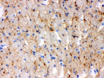 IHC testing of frozen mouse heart tissue with CPT1B antibody. 