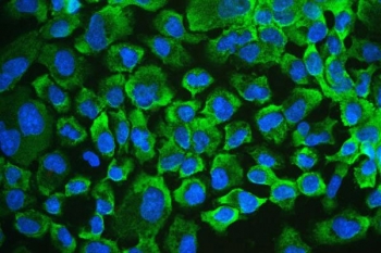 Immunofluorescence analysis of UPF1 / RENT1 antibody in human A431 cells. FFPE human A431 cells show cytoplasmic green fluorescence consistent with UPF1 expression, while nuclei are counterstained with DAPI (blue). The signal is predominantly cytoplasmic with a perinuclear distribution pattern, and nuclear staining is minimal under the conditions tested. Heat induced epitope retrieval was performed by steaming sections in citrate buffer, pH 6.0, for 20 minutes prior to immunostaining.