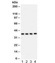 Western blot testing of 1) human placenta, 2) HeLa, 3) HUT and 4) Jurkat lysate with PINX1 antibody. Predicted/observed molecular weight ~37 kDa.